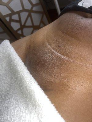 Brazilian Wax