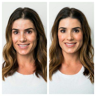 before and after of a client that has a skin condition called melasma. Our custom foundation creates full coverage for this client.