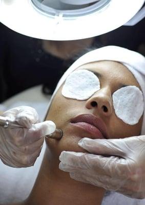 Diamond tip Microdermabrasion