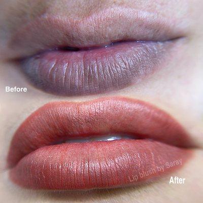 Lip neutralization with lip blush