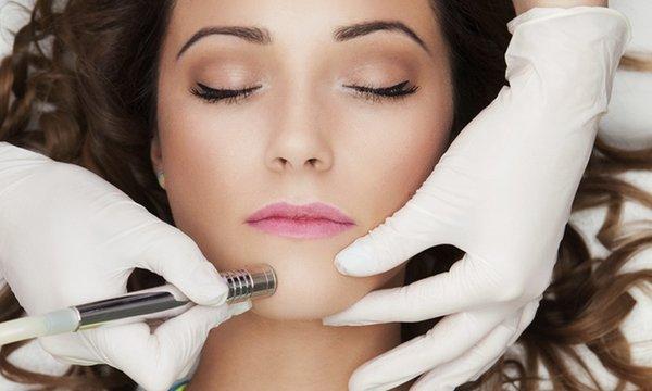 Microdermabrasion