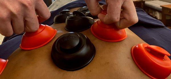 Cupping Massage Therapy - Fascial Movement Technique