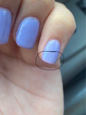 Example of a less pigmented nail