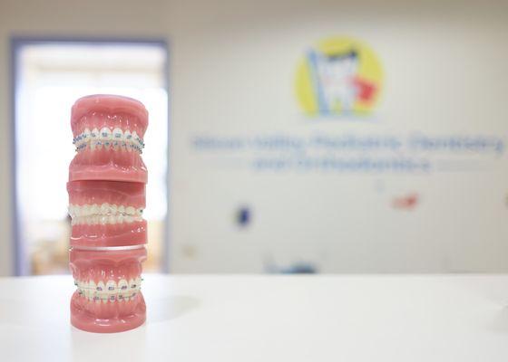 Patient educations models with examples of our orthodontic treatment