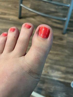 Burn seen on toe. Uneven coat, uneven and chipping nails.