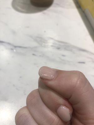 Chipped thumb that I tried to super glue back