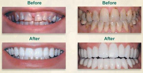 Cosmetic Dentistry