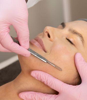 Columbia Laser and Aesthetics Center - Dermaplaning