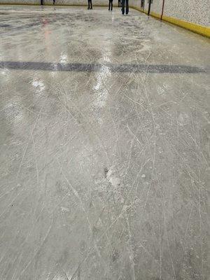 Awful ice conditions here for skaters of ALL levels. They plan to redo the ice by Summer 2023.