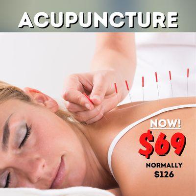 Acupuncture discount