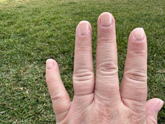 Gel polish pooling on the sides of ginger nails. Index finger chipping after two days.