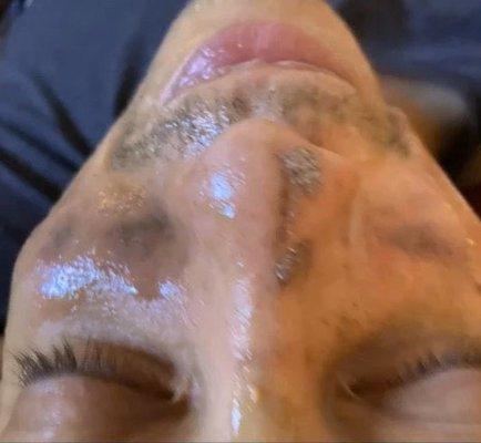 Amazing facial!!