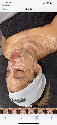 Facial