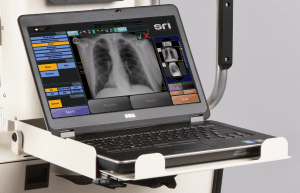 Mobile X-ray services at your residence