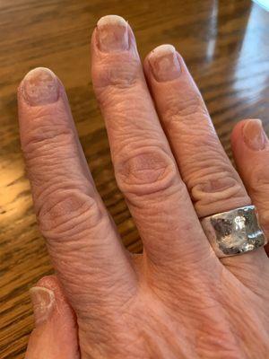 Gel polish removed by salon owner.