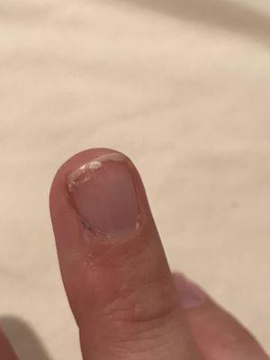 Gel French Manicure, nail completely chipped off 3 days post manicure.