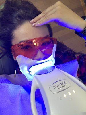 Zoom tooth whitening!