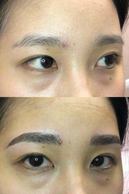 Microblading