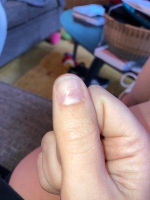 The dent in my nails left after the filing.