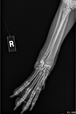 X-ray