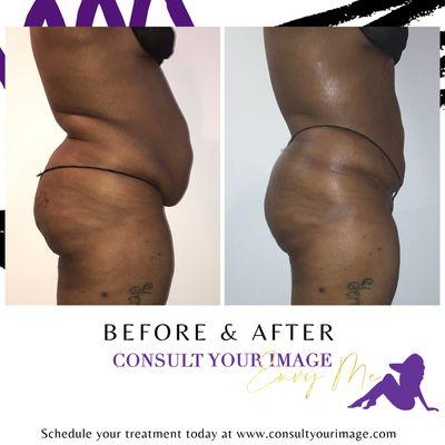 One session of wood sculpting offers same day transformations