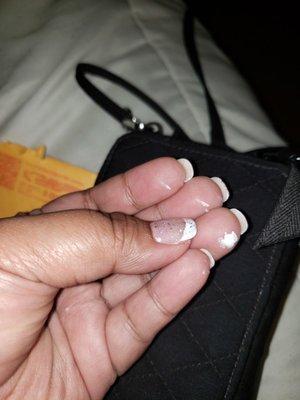 Another photo of the white gel polish stuck on my skin