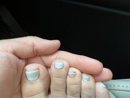 Horrible nail job