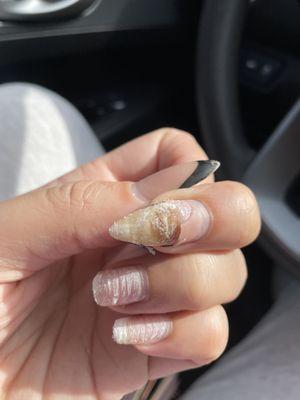 Discoloration on real nail