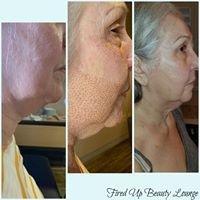 Wrinkle reduction!