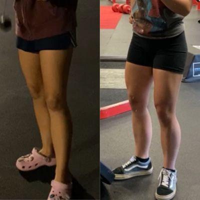 before and after pictures for my legs!