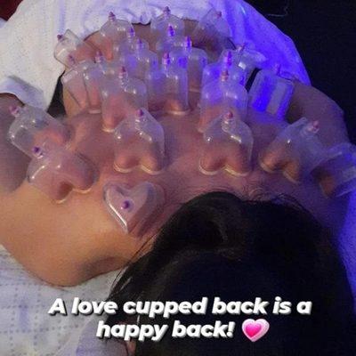 Selflove Cupping Therapy