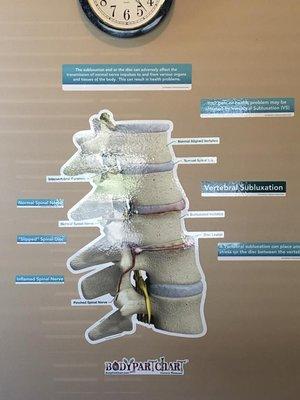 Vertebral Subluxation