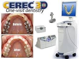 CEREC One Visit Crown Technology!