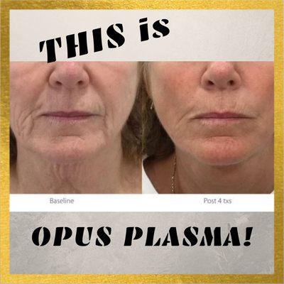 Opus Plasma is MORE than everything it's cracked up to be!