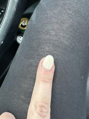 Crocked nail