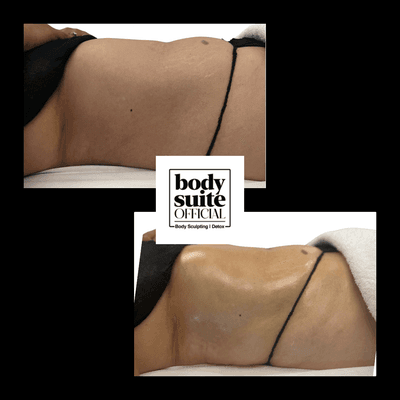 Goodbye bloat! Before & After our signature Lymphatic Drainage massage!