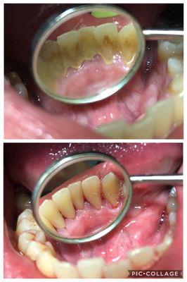 A BEFORE AND AFTER PICTURE OF DEEP CLEANING