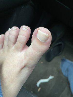 The pics showing the awful pedi says it all