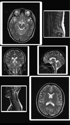 The quality of the diagnostic images done at HTC medical imaging