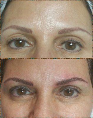 Before &After Microblading