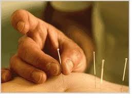 California Acupuncture and Natural Medicine