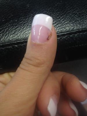 Left thumb nail that got RIPPED off..