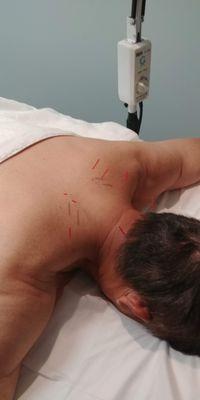 neck and upper back treatment