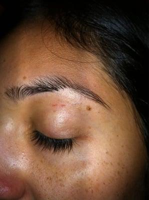 Uneven, horrible eye brow job and my skin was cut open