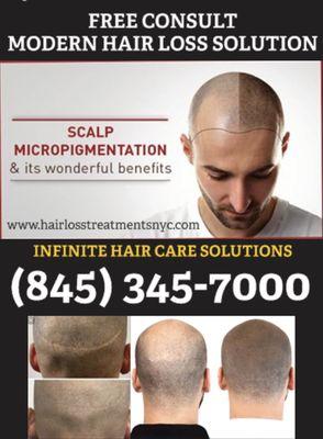 Scalp Micropigmentation is a noninvasive treatment for hair loss.