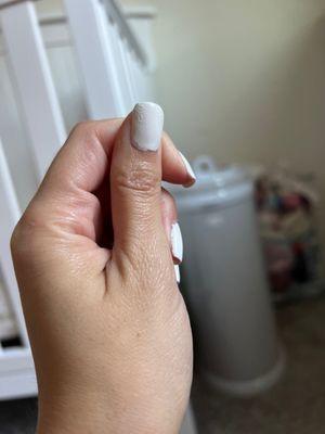 Wrinkled nail