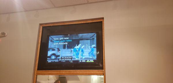 You can watch TV during the procedure