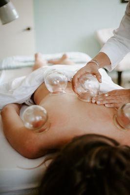 Cupping therapy