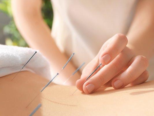 Jade Clinic of Fertility Acupuncture