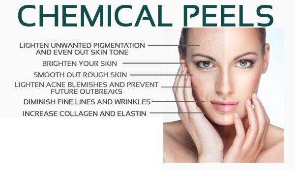 Chemical Peels